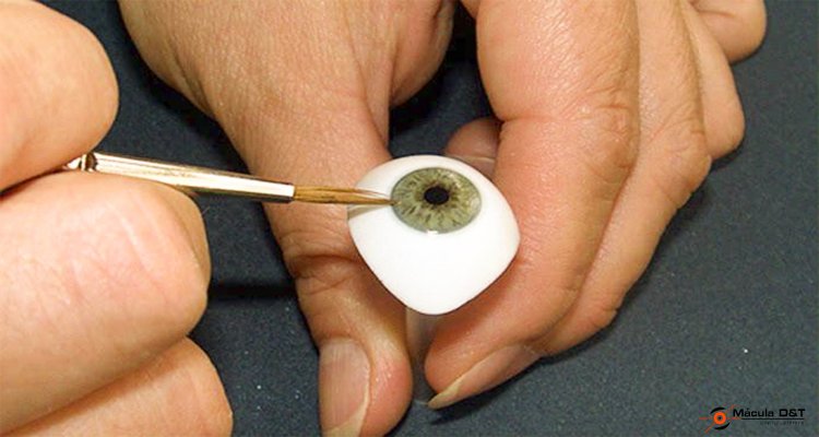 Prótesis Ocular